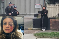 Australian Politician Faces Blindness Risk After Pro-Palestine Protest Arrest